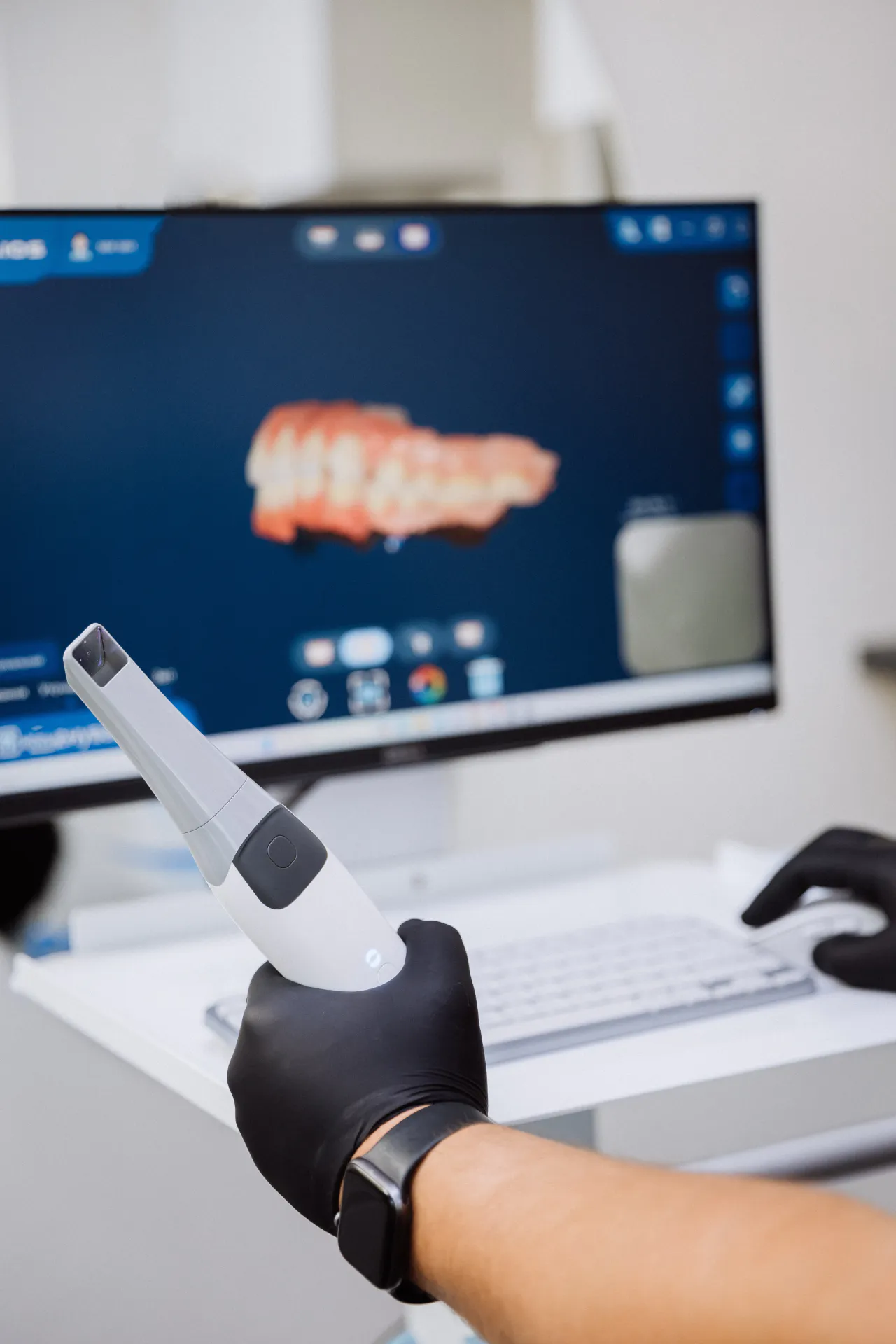 An intraoral scanner beside a screen showing the finished 3D scan