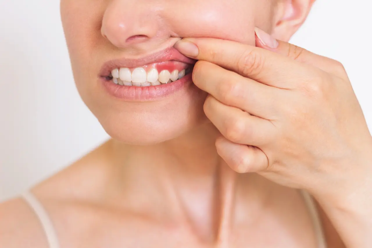 A patient lifting her lip to show healthy gums
