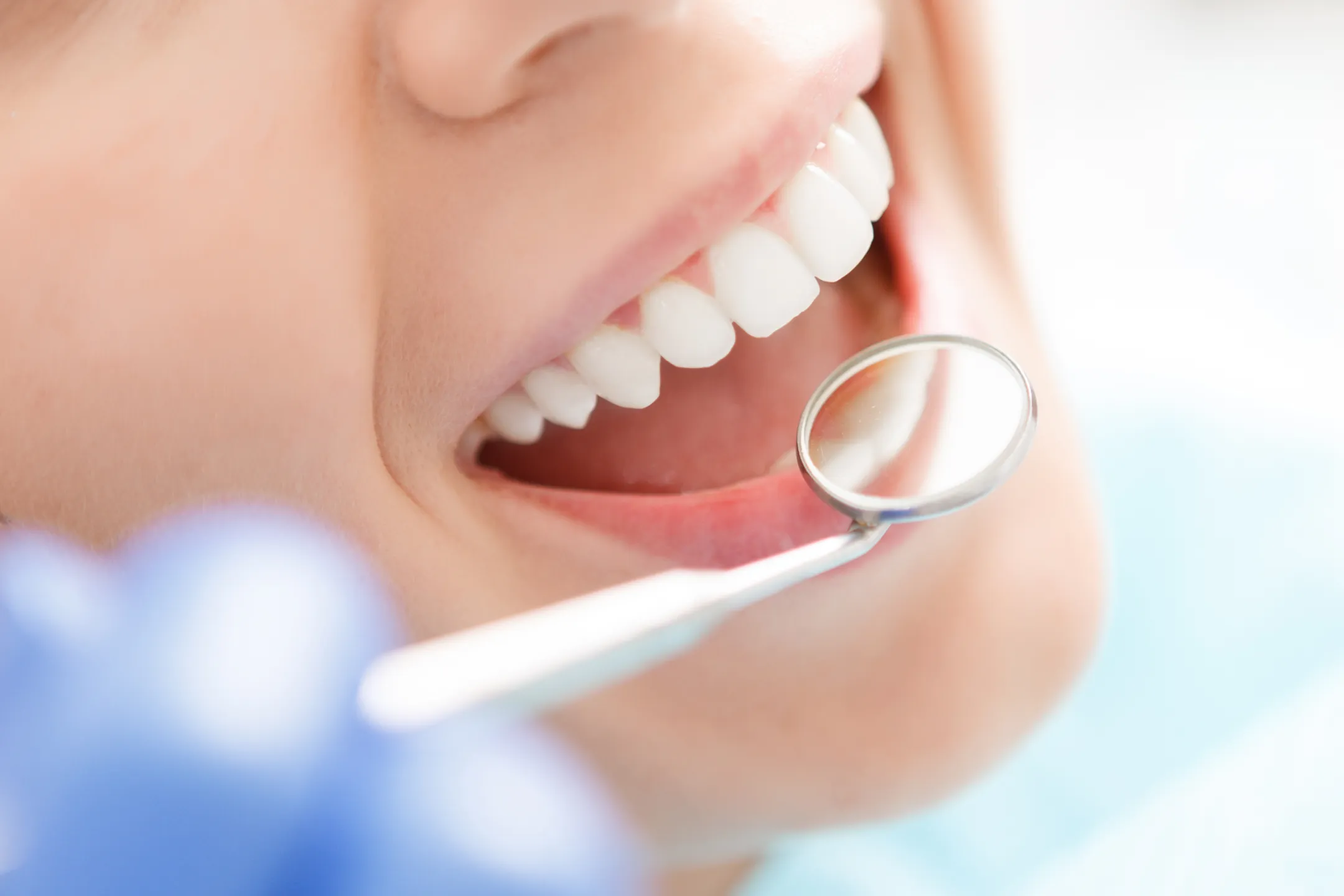 A close-up of a bright smile during a dental exam